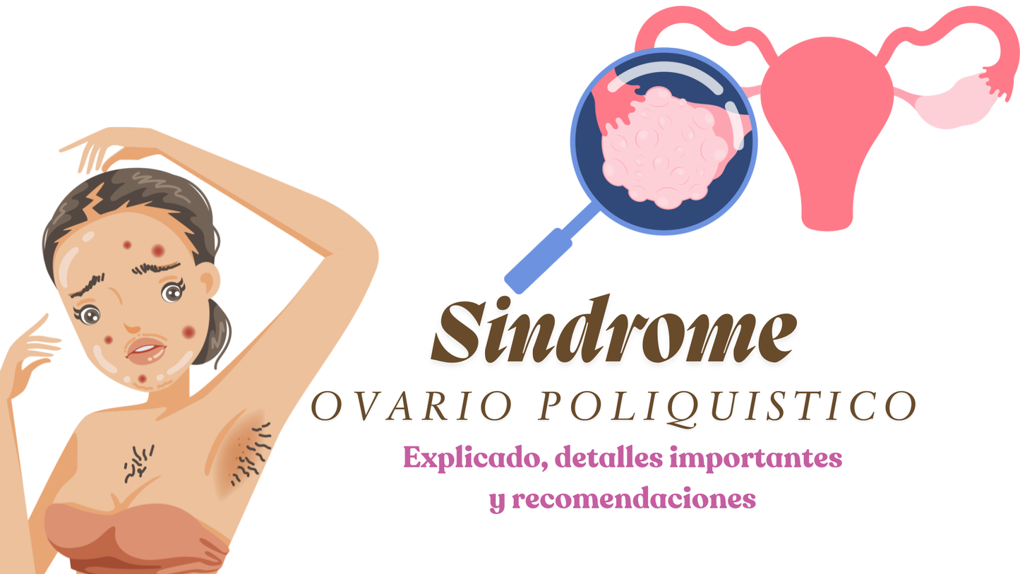 Taller: Sindrome ovario poliquistico